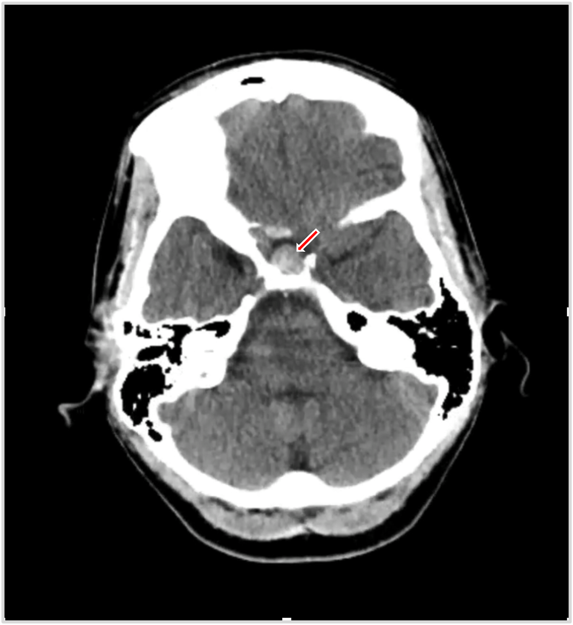 Image IQ Quiz: Postpartum 27-Year-Old Female with Hypotension
