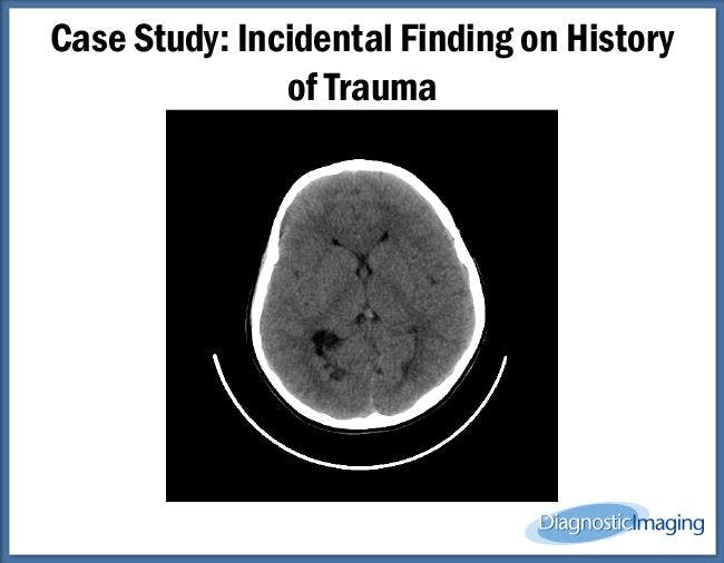 Incidental Finding on History of Trauma