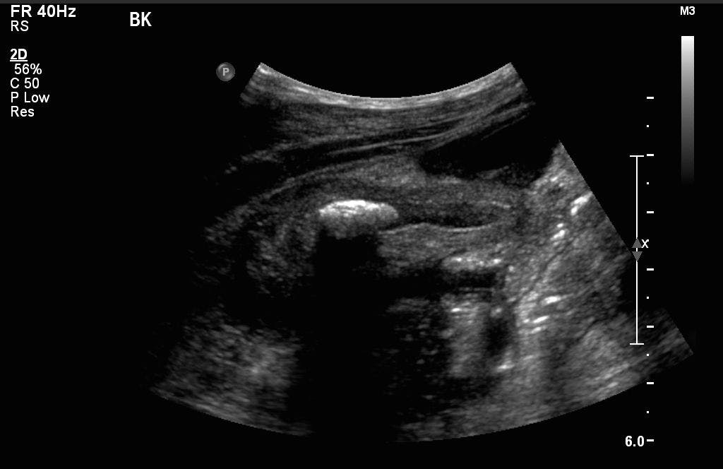 Image IQ: 9-year-old Male with Abdominal Pain