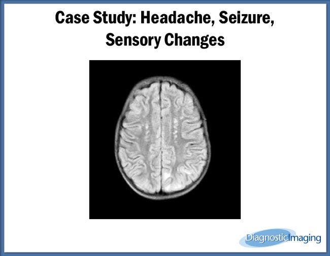 Headache, Seizure, Sensory Changes