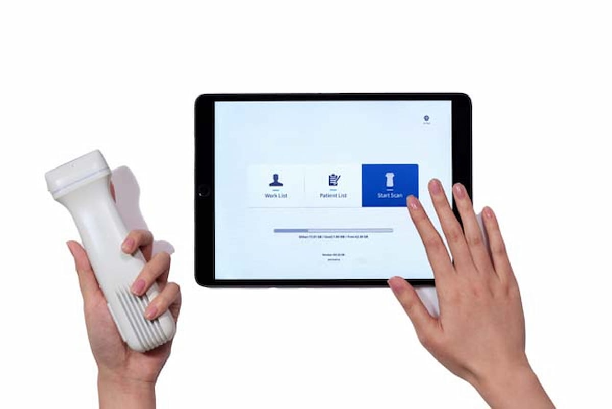 Konica Minolta Launches New Handheld Ultrasound Device