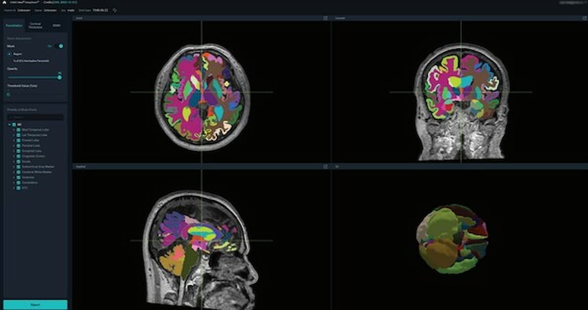FDA Clears Emerging AI Software for Brain MRI