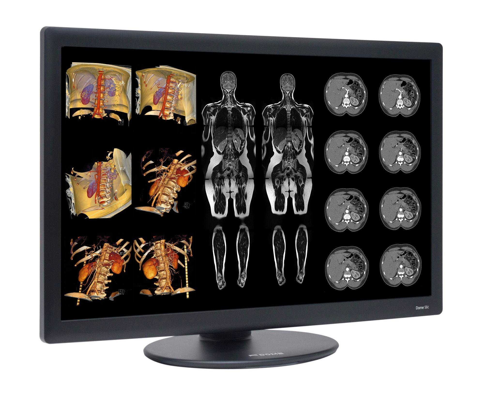 FDA Clearance Given for 6 MP LED Widescreen Radiology Display