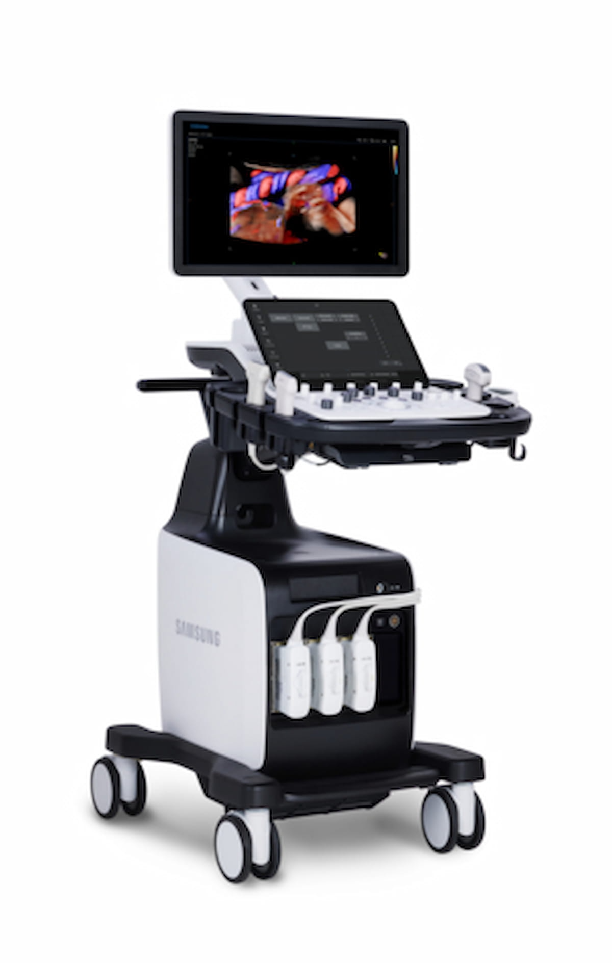 Samsung Debuts New Ultrasound Modality Geared to Women’s Health and Urology