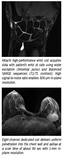 Novel designs distinguish Hitachi's MRI scanners