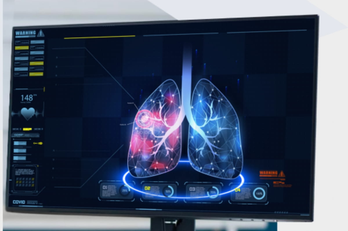 FDA Clears AI-Powered CT Assessment Tool for Lung Fibrosis 