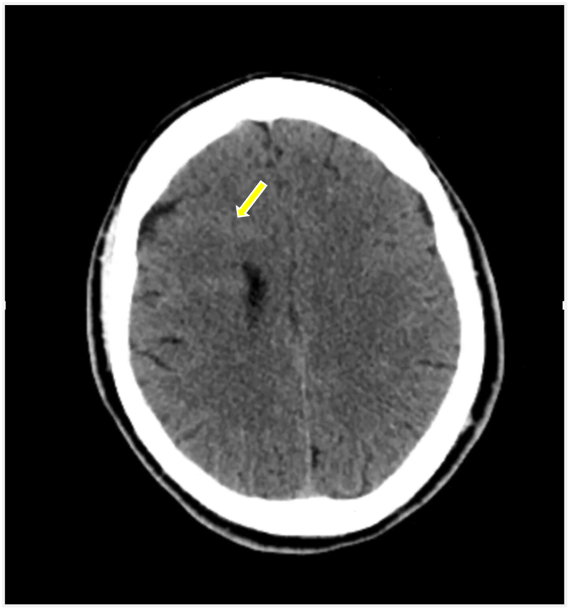 Image IQ Quiz: 40-Year-Old Male with Seizure Disorder