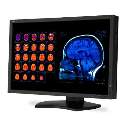30-inch NEC PACS Display wins FDA Approval