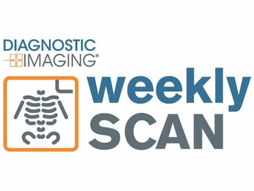 Diagnostic Imaging's Weekly Scan: May 29-June 3