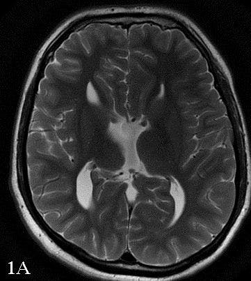 Image IQ: 30-year-old Male With Nonspecific Headaches