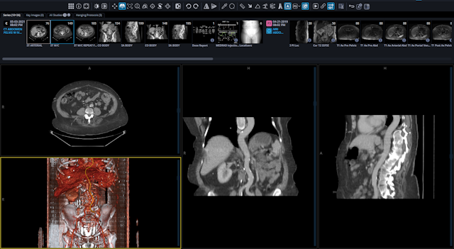 Could the New Stratus Imaging PACS Viewer Help Streamline Radiology Workflows?