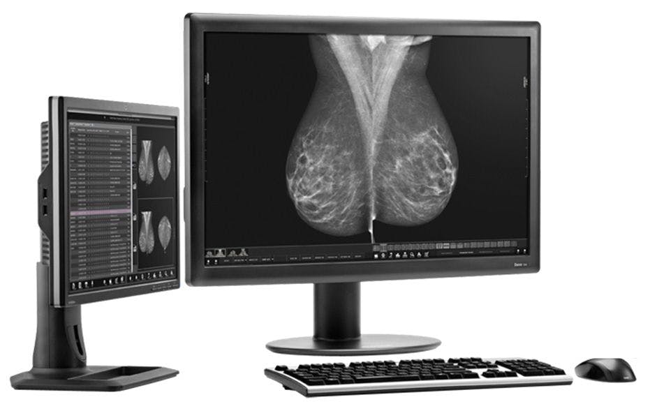 TPS Debuts Updated Breast Imaging Workstation
