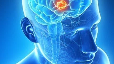 PET/MRI + Radiopharmaceuticals Can Identify Malignant Brain Tumors