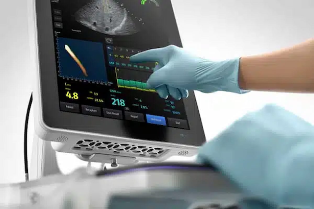 New System Combines Diagnostic Ultrasound and Transient Elastography