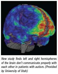 FMRI shows connections missing in autistic brains