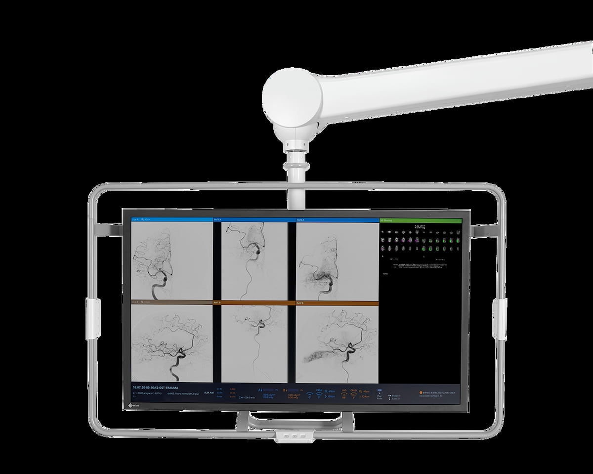 FDA Clears AI-Powered Qualitative Perfusion Mapping for Cone-Beam CT 
