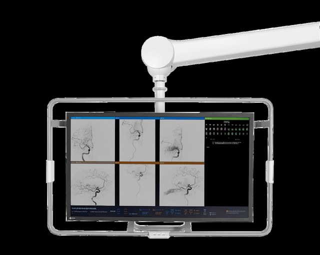 FDA Clears AI-Powered Qualitative Perfusion Mapping for Cone-Beam CT 