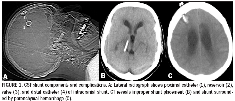 Intracranial implant materialeffects create reporting issues