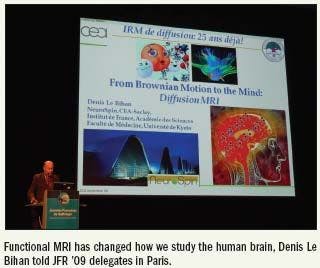 French congress celebrates 25 years of diffusion MRI’s revolution inbrain anatomic and functional imaging