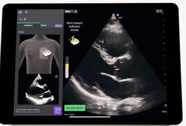 GE HealthCare Adds AI Guidance to Cardiac Ultrasound Assessments with Vscan Air SL 