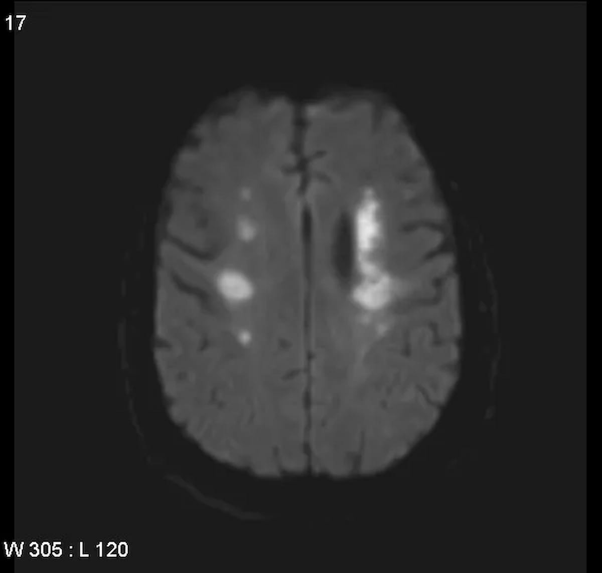 Image IQ Quiz: 50-Year-Old Male with Prolonged Dehydration and Hypotension