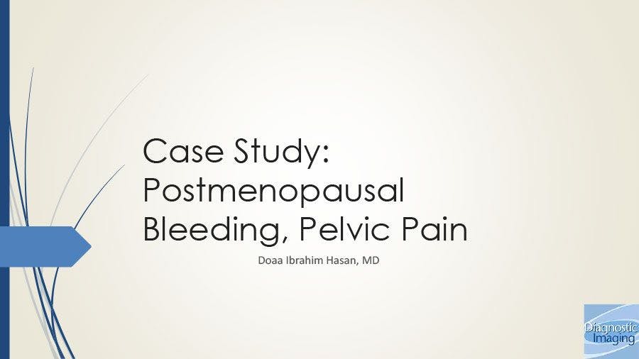 Postmenopausal Bleeding, Pelvic Pain