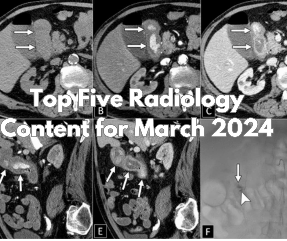 Top Five Radiology Content for March 2024