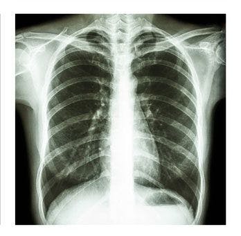 Necessity of Technologist-Directed Repeat Chest, Musculoskeletal X-Rays