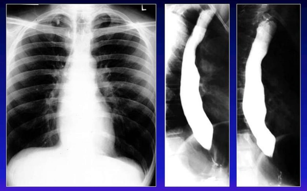 Image IQ Quiz: Patient with Difficulty Swallowing Food