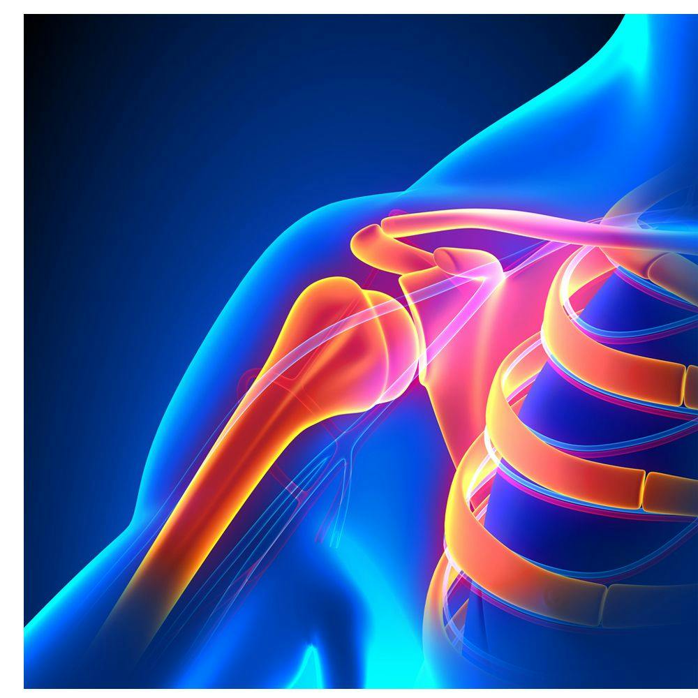 Necessity of Routine X-Rays After Shoulder Arthroplasty 