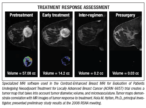 Depth increases in lineupof breast imaging options
