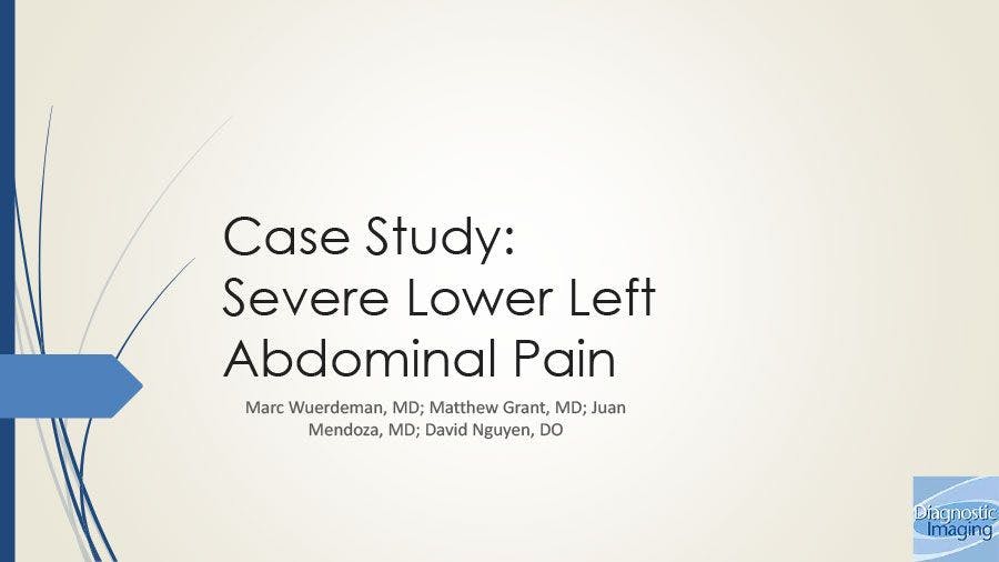 Severe Lower Left Abdominal Pain