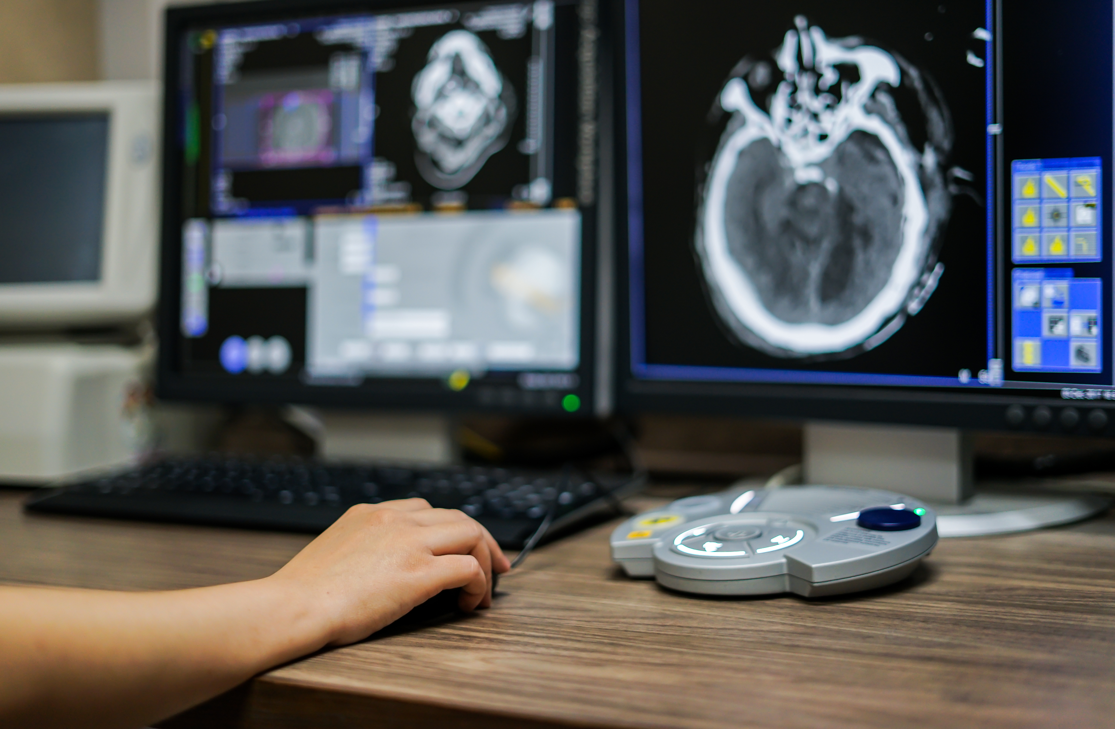 What Would the Perfect AI Do for This Radiologist?