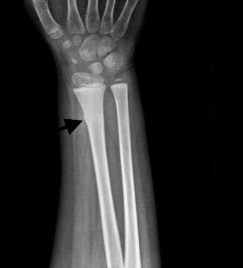 Image IQ: 7-year-old with Pain after Fall