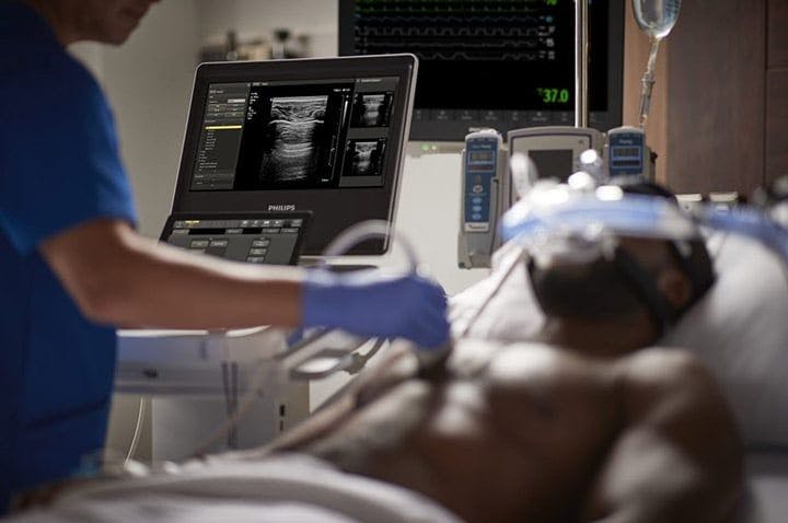 Philips Gets FDA Clearance for Ultrasound 5000 Compact Series