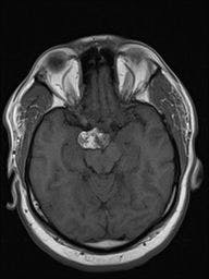Image IQ: 46-year-old Male with Headache