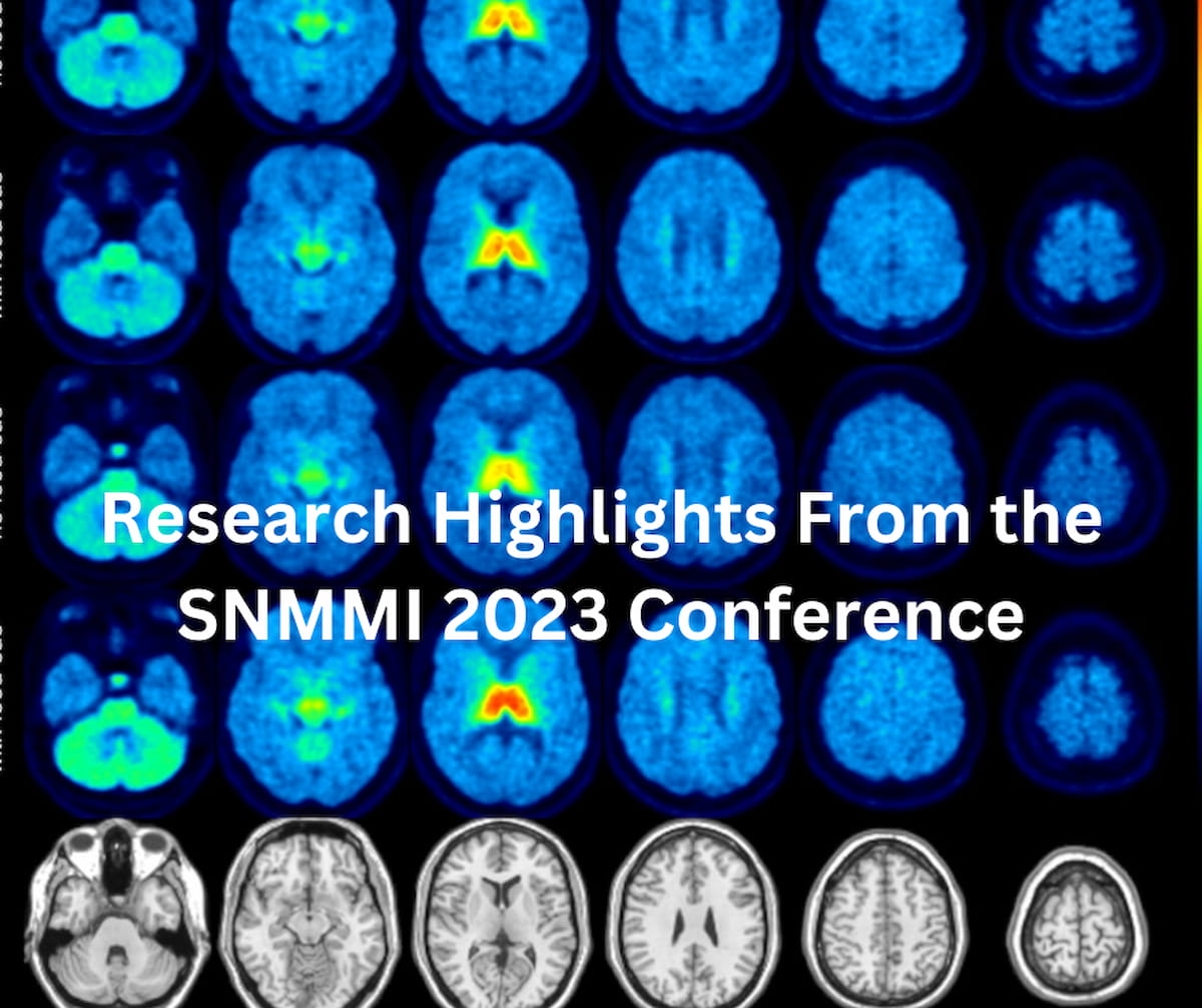 Research Highlights from the SNMMI Conference
