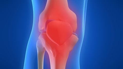 A Knee MRI in Half the Time? It’s Possible
