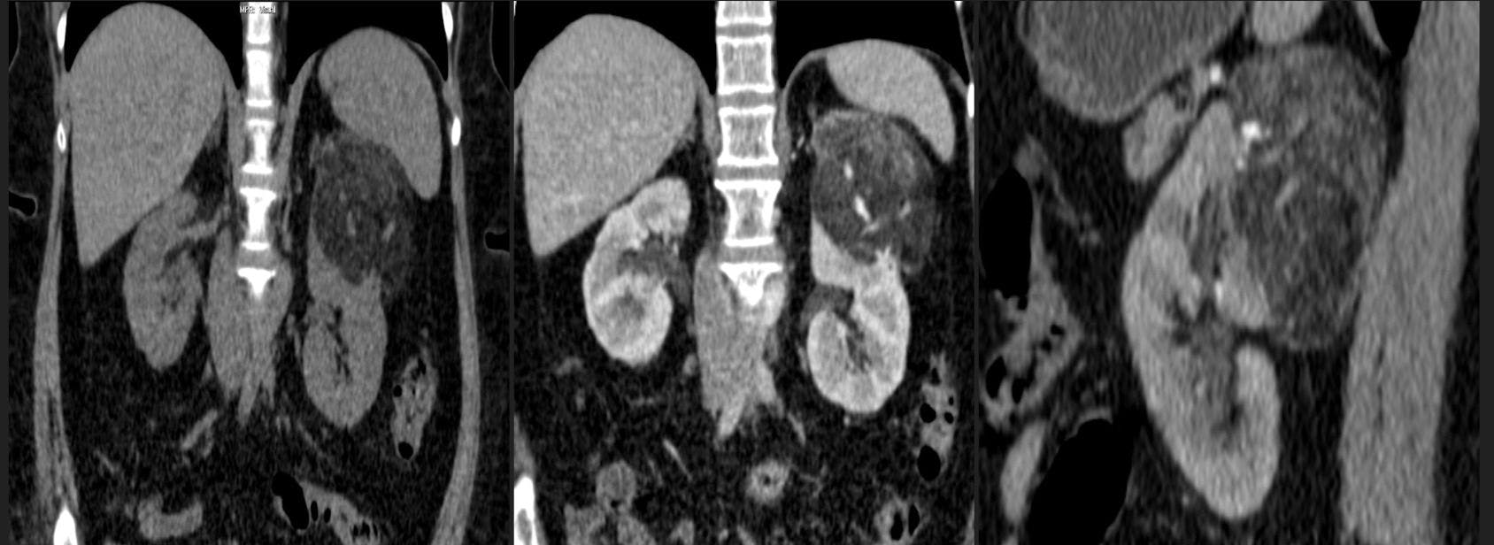 Image IQ: 45-Year-Old Male Patient Presenting with Right Upper Quadrant Pain