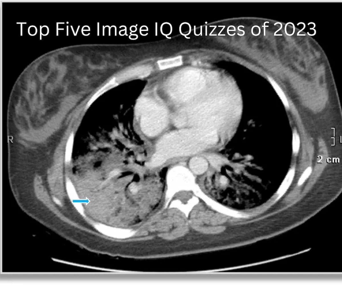 Diagnostic Imaging's Top Five Image iQ Quizzes of 2023