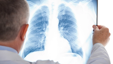 Integrating AI Into Radiology Practice to Enhance Lung Disease Prediction and Diagnosis