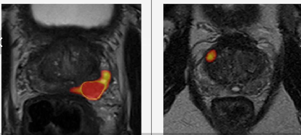 Can Autonomous AI Help Reduce Prostate MRI Workloads Without Affecting Quality?